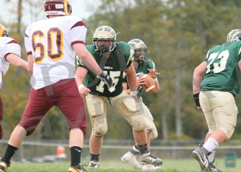 Glcath_JV140